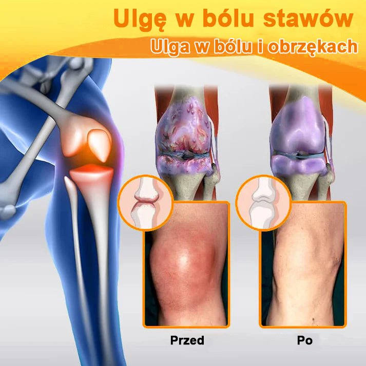 ✅Oficjalny sklep: Ourlyard™ Olej magnezowy i miód w sprayu do naprawy stawów👨⚕️Zatwierdzony przez Polską Agencję Leków, Wyrobów Medycznych i Produktów Biologicznych (URPL)🔥