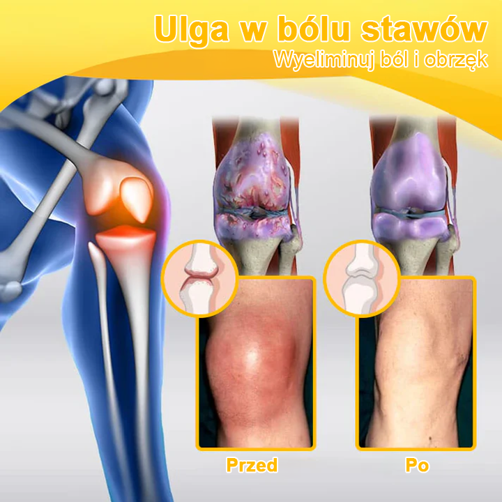 ✅ TLOPA® Przeciwbólowy krem wspierający regenerację kości z toksyną botulinową i jadem pszczelim 🐝🐝