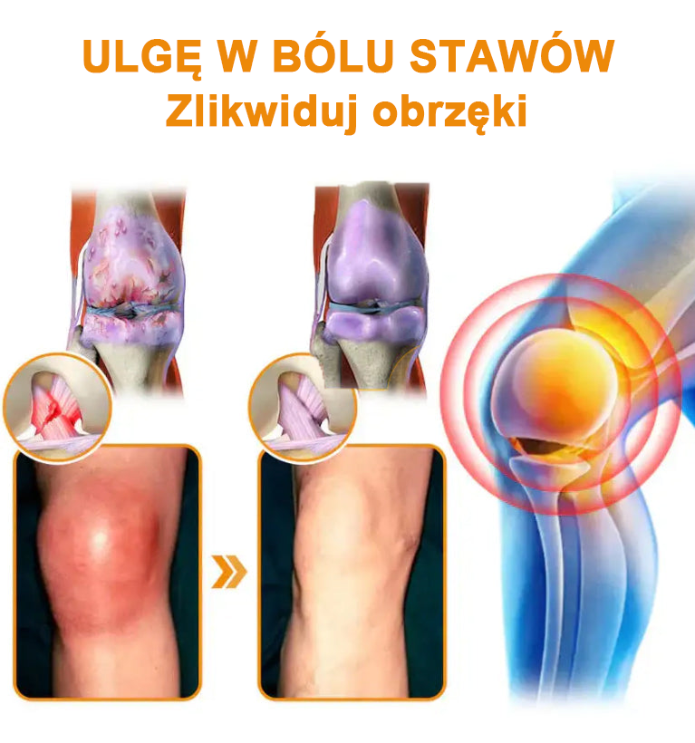 ✅Oficjalny sklep: Ourlyard™ Olej magnezowy i miód w sprayu do naprawy stawów👨⚕️Zatwierdzony przez Polską Agencję Leków, Wyrobów Medycznych i Produktów Biologicznych (URPL)🔥