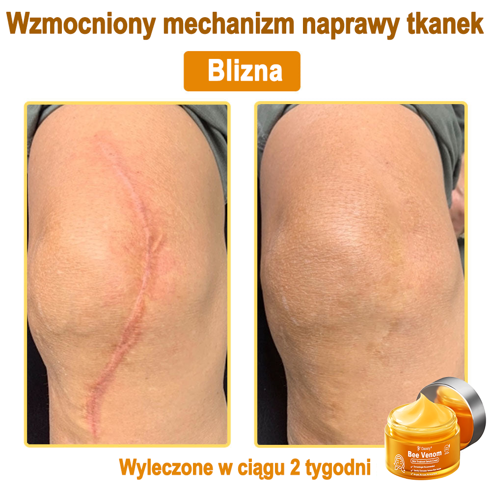 Daasry® 𝑩𝒆𝒆 𝑽𝒆𝒏𝒐𝒎 𝑺𝒌𝒊𝒏 𝑻𝒓𝒆𝒂𝒕𝒎𝒆𝒏𝒕 𝑺𝒆𝒓𝒖𝒎 𝑪𝒓𝒆𝒂𝒎👨⚕️ (Suitable for all ages & TGA recommends)