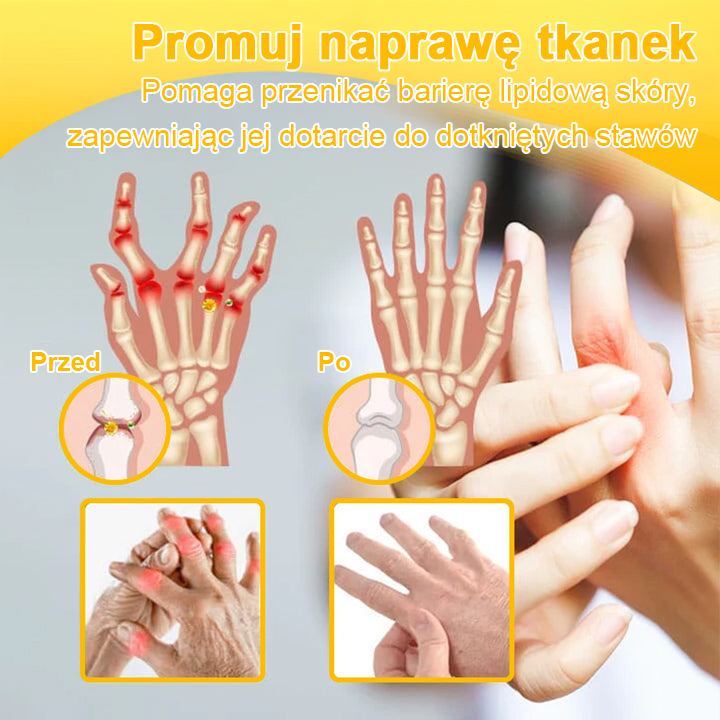 ✅ TLOPA® Przeciwbólowy krem wspierający regenerację kości z toksyną botulinową i jadem pszczelim 🐝🐝