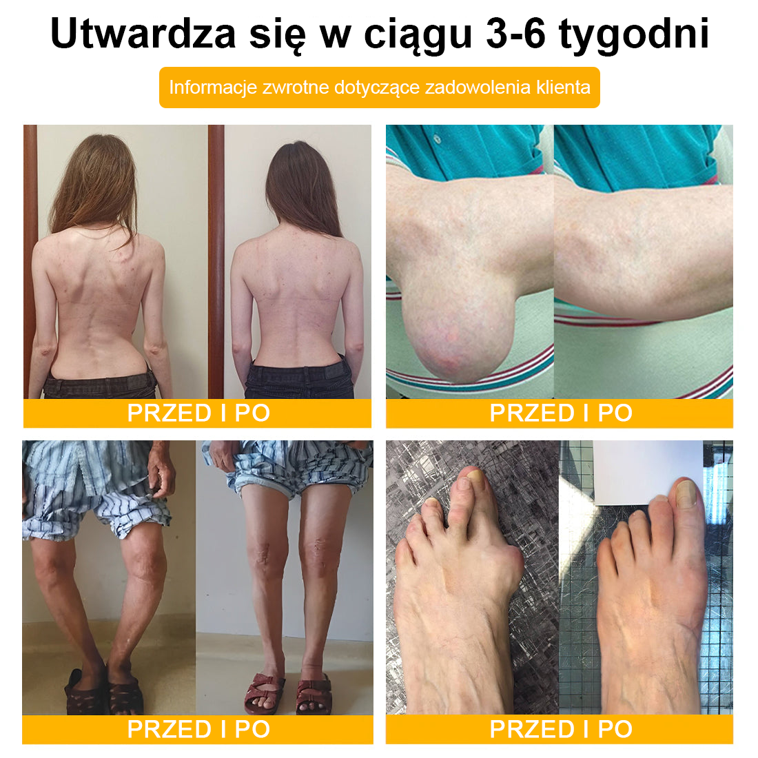 ✅ TLOPA® Przeciwbólowy krem wspierający regenerację kości z toksyną botulinową i jadem pszczelim 🐝🐝