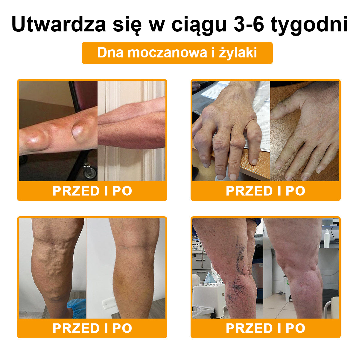 ✅ TLOPA® Przeciwbólowy krem wspierający regenerację kości z toksyną botulinową i jadem pszczelim 🐝🐝