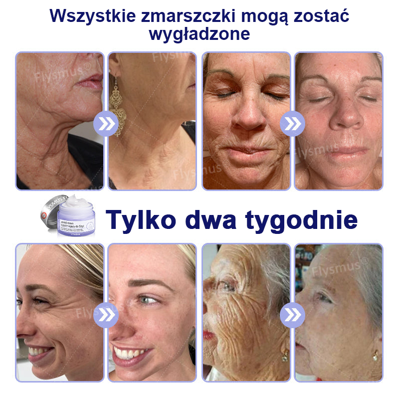 🎁Promocja specjalna – Flysmus® AH-8 Krem do napięcia i liftingu szyi – Ostatni dzień zniżki 70%