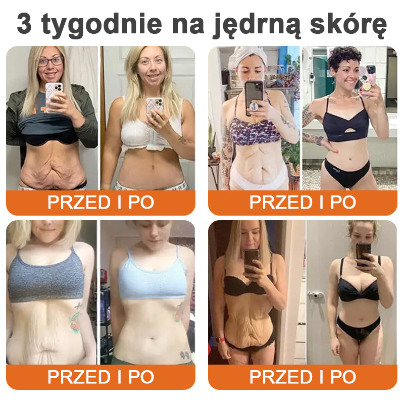 flysmus™ Botox Bee Venom Firming Serum Stick (🔥OSTATNI DZIEŃ 70% ZNIŻKI)💄💄