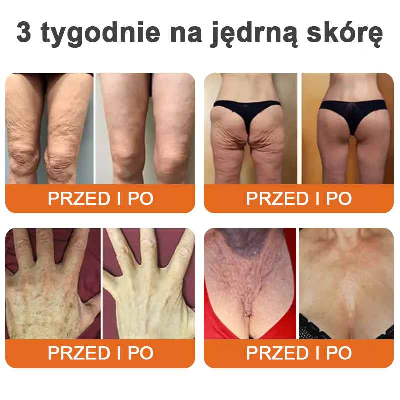 flysmus™ Botox Bee Venom Firming Serum Stick (🔥OSTATNI DZIEŃ 70% ZNIŻKI)💄💄