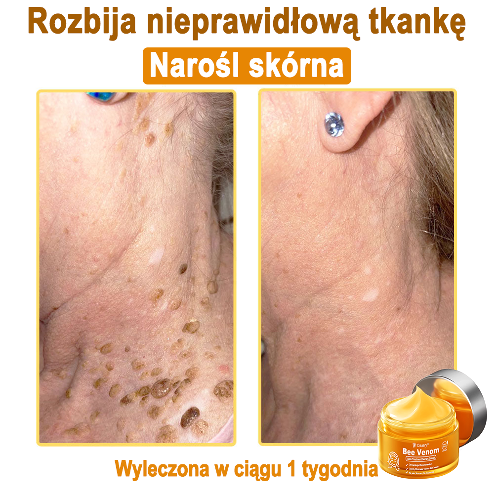 Daasry® 𝑩𝒆𝒆 𝑽𝒆𝒏𝒐𝒎 𝑺𝒌𝒊𝒏 𝑻𝒓𝒆𝒂𝒕𝒎𝒆𝒏𝒕 𝑺𝒆𝒓𝒖𝒎 𝑪𝒓𝒆𝒂𝒎👨⚕️ (Suitable for all ages & TGA recommends)