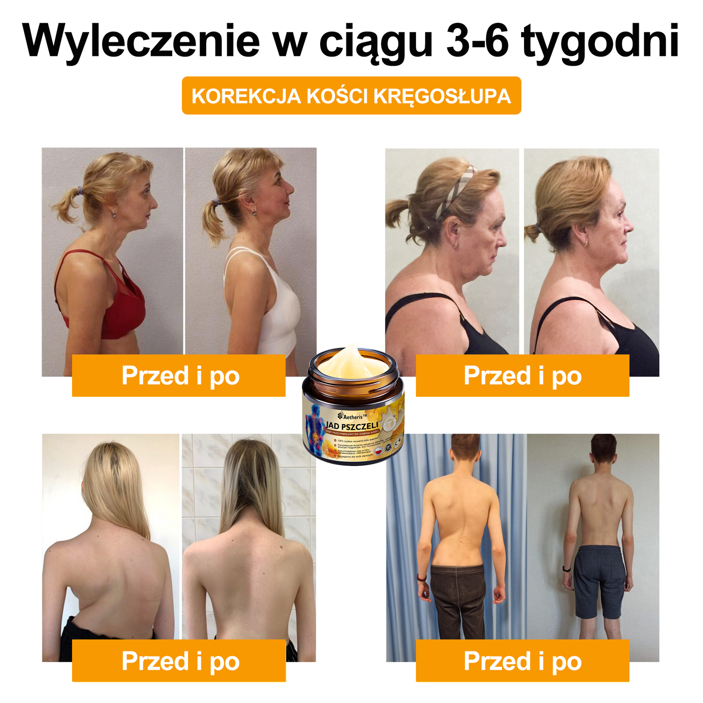 Oficjalny sklep: Aetheris™ Krem terapeutyczny z jadem pszczelim na natychmiastową, ultra silną ulgę w bólu - (Zapewnia eliminację bólu przy zapaleniu stawów, bólach mięśni, pleców, kolan, ramion, bioder, nadgarstków, dłoni)