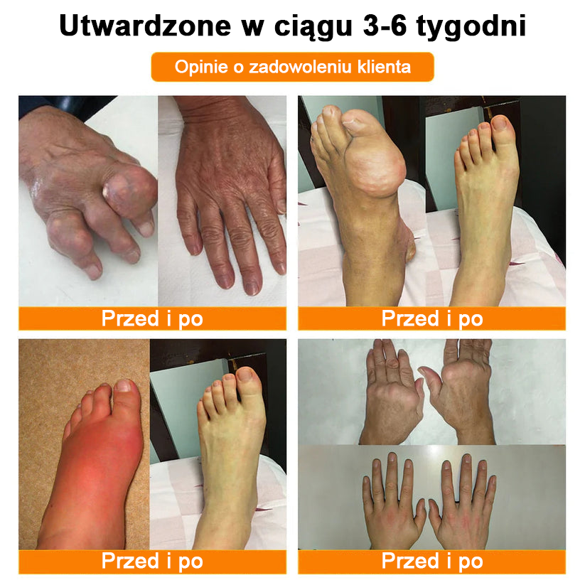 ✅Oficjalny sklep: Ourlyard™ Olej magnezowy i miód w sprayu do naprawy stawów👨⚕️Zatwierdzony przez Polską Agencję Leków, Wyrobów Medycznych i Produktów Biologicznych (URPL)🔥