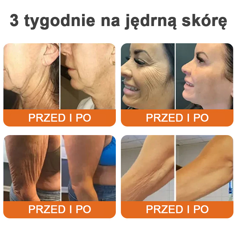 flysmus™ Botox Bee Venom Firming Serum Stick (🔥OSTATNI DZIEŃ 70% ZNIŻKI)💄💄