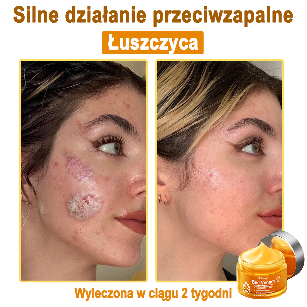 Daasry® 𝑩𝒆𝒆 𝑽𝒆𝒏𝒐𝒎 𝑺𝒌𝒊𝒏 𝑻𝒓𝒆𝒂𝒕𝒎𝒆𝒏𝒕 𝑺𝒆𝒓𝒖𝒎 𝑪𝒓𝒆𝒂𝒎👨⚕️ (Suitable for all ages & TGA recommends)
