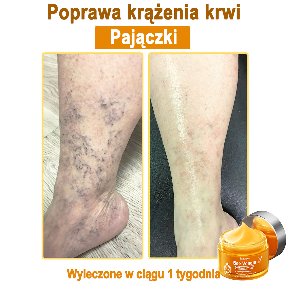 Daasry® 𝑩𝒆𝒆 𝑽𝒆𝒏𝒐𝒎 𝑺𝒌𝒊𝒏 𝑻𝒓𝒆𝒂𝒕𝒎𝒆𝒏𝒕 𝑺𝒆𝒓𝒖𝒎 𝑪𝒓𝒆𝒂𝒎👨⚕️ (Suitable for all ages & TGA recommends)