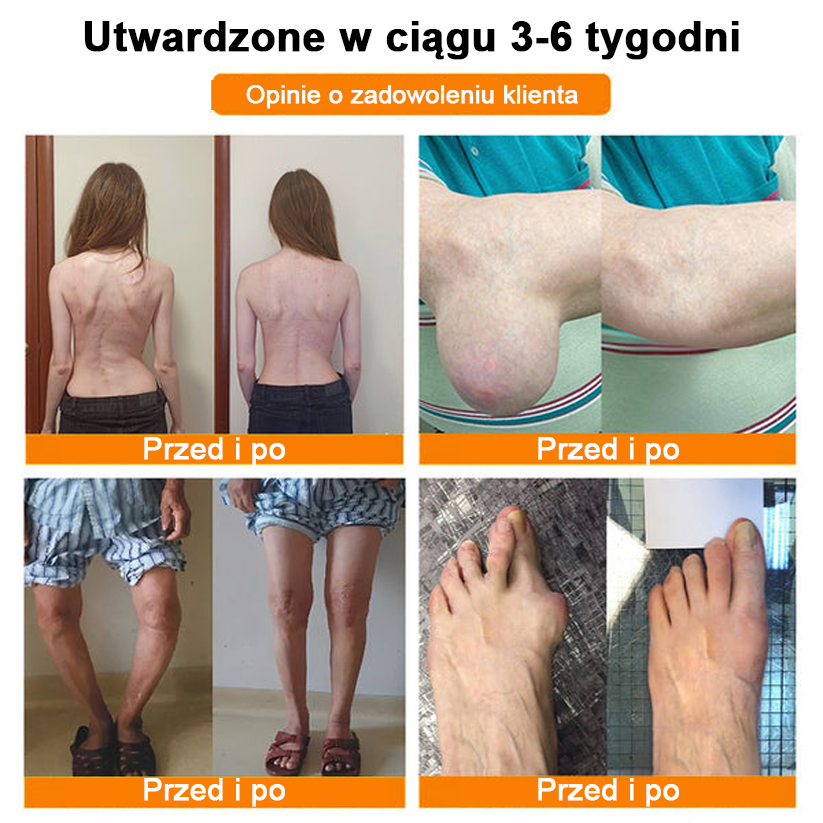 ✅Oficjalny sklep: Ourlyard™ Olej magnezowy i miód w sprayu do naprawy stawów👨⚕️Zatwierdzony przez Polską Agencję Leków, Wyrobów Medycznych i Produktów Biologicznych (URPL)🔥