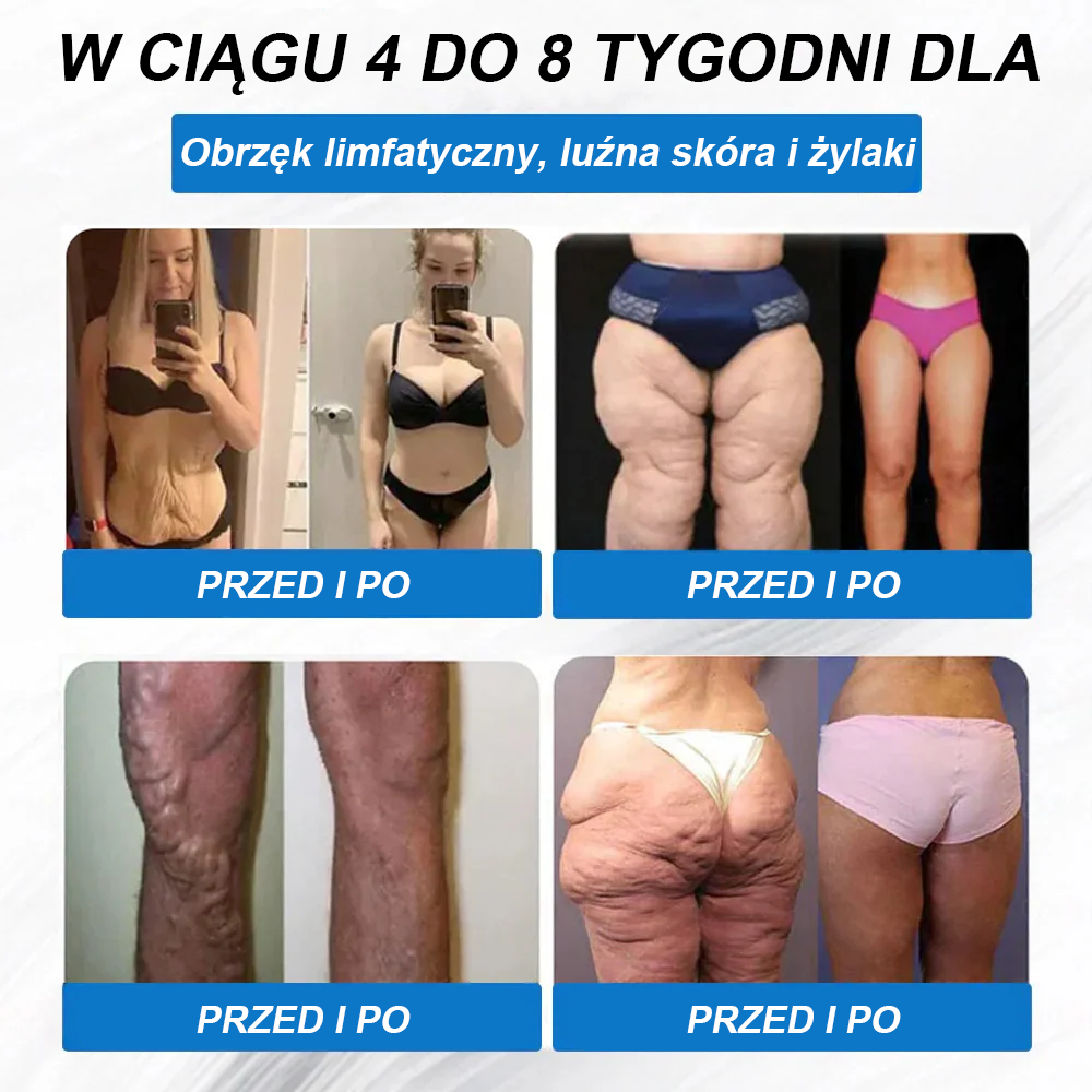 WarmFamily® SMGT-GLP-1 Nano Plaster z Mikronakłuciami z Kolagenem i Matrixylem 3000 ✅ | Klinicznie potwierdzone działanie na odchudzanie, zdrowie sercowo-naczyniowe, cukrzycę i inne problemy zdrowotne, polecany przez lekarzy 👨⚕️