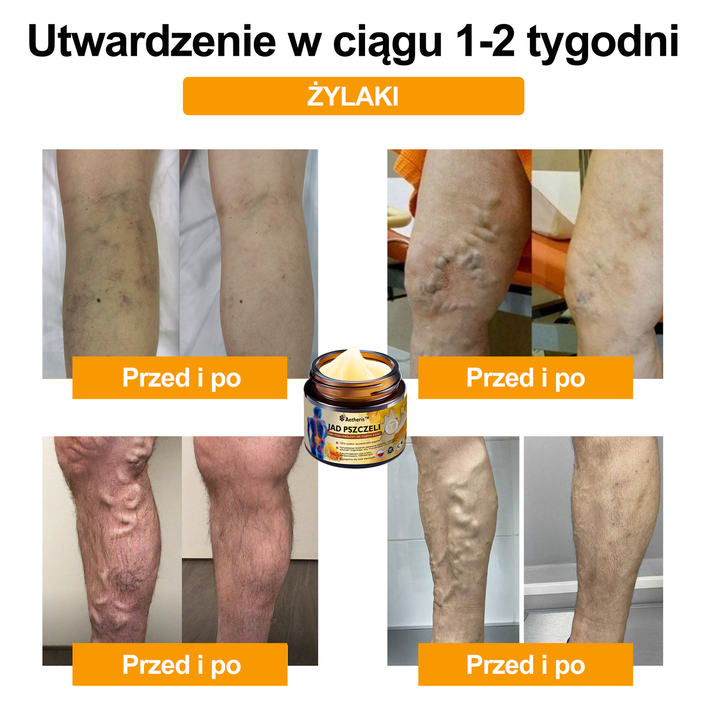 Oficjalny sklep: Aetheris™ Krem terapeutyczny z jadem pszczelim na natychmiastową, ultra silną ulgę w bólu - (Zapewnia eliminację bólu przy zapaleniu stawów, bólach mięśni, pleców, kolan, ramion, bioder, nadgarstków, dłoni)