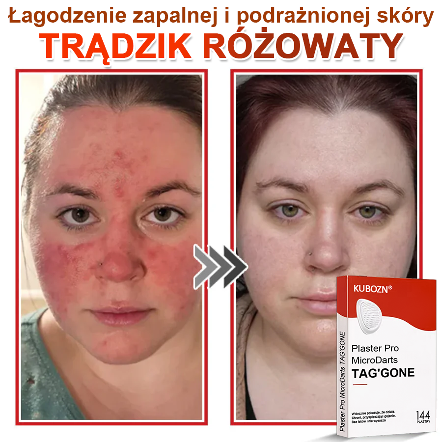 🌈 KUBOZN® Mikroigłowy Botaniczny Plaster na Usuwanie Brodawek Skórnych