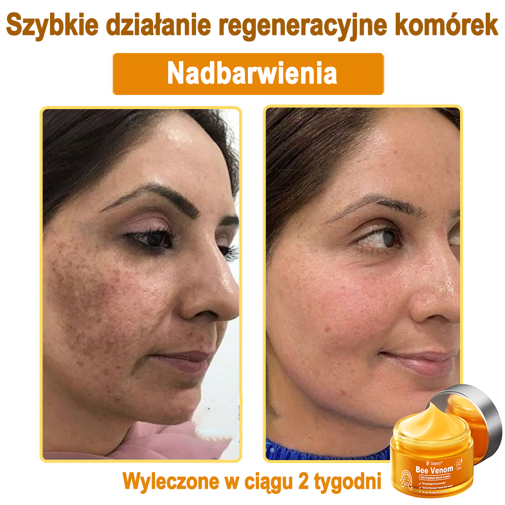 Daasry® 𝑩𝒆𝒆 𝑽𝒆𝒏𝒐𝒎 𝑺𝒌𝒊𝒏 𝑻𝒓𝒆𝒂𝒕𝒎𝒆𝒏𝒕 𝑺𝒆𝒓𝒖𝒎 𝑪𝒓𝒆𝒂𝒎👨⚕️ (Suitable for all ages & TGA recommends)