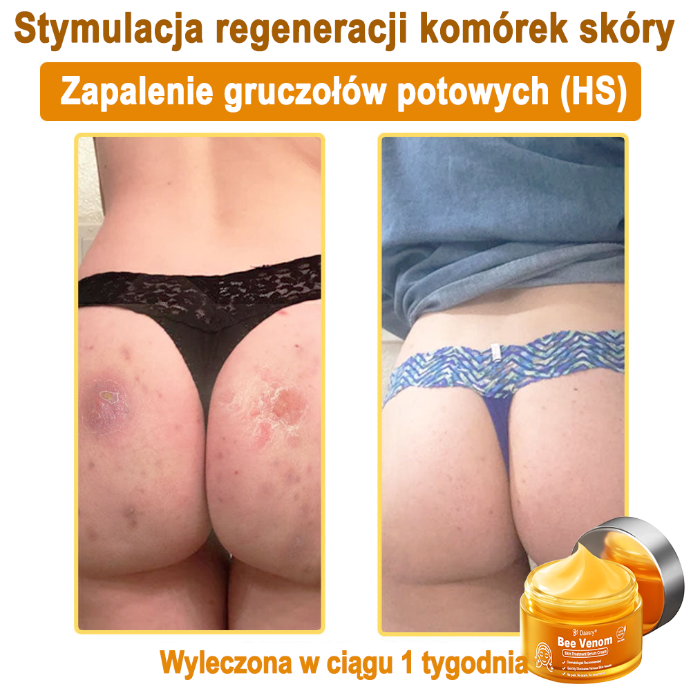 Daasry® 𝑩𝒆𝒆 𝑽𝒆𝒏𝒐𝒎 𝑺𝒌𝒊𝒏 𝑻𝒓𝒆𝒂𝒕𝒎𝒆𝒏𝒕 𝑺𝒆𝒓𝒖𝒎 𝑪𝒓𝒆𝒂𝒎👨⚕️ (Suitable for all ages & TGA recommends)
