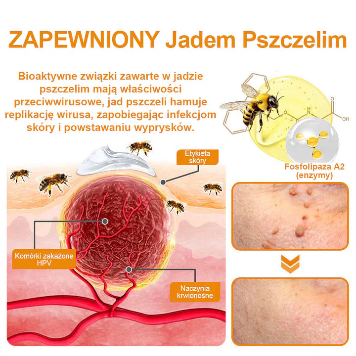 【✨Za pobraniem✨】Vsoxa™ Krem do usuwania brodawek i pieprzyków z jadem pszczelim (👨⚕Zalecenia AAD) 🐝🐝 (🔥Ostatni dzień wyprzedaży 70% taniej)
