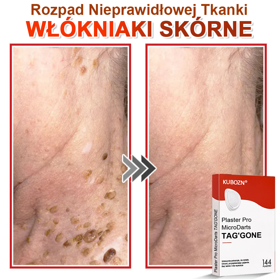 🌈 KUBOZN® Mikroigłowy Botaniczny Plaster na Usuwanie Brodawek Skórnych