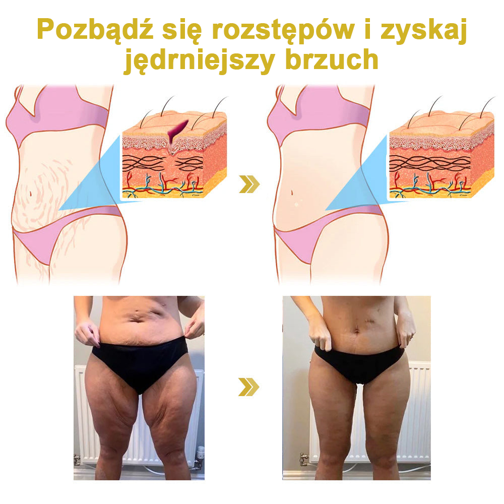 Zwycięzca nagrody 2024 Readers' Choice 🏆 𝐌𝐨𝐨𝐧𝐝𝐚𝐫™ Krem ujędrniający i odnawiający: Przywrócenie elastyczności skóry