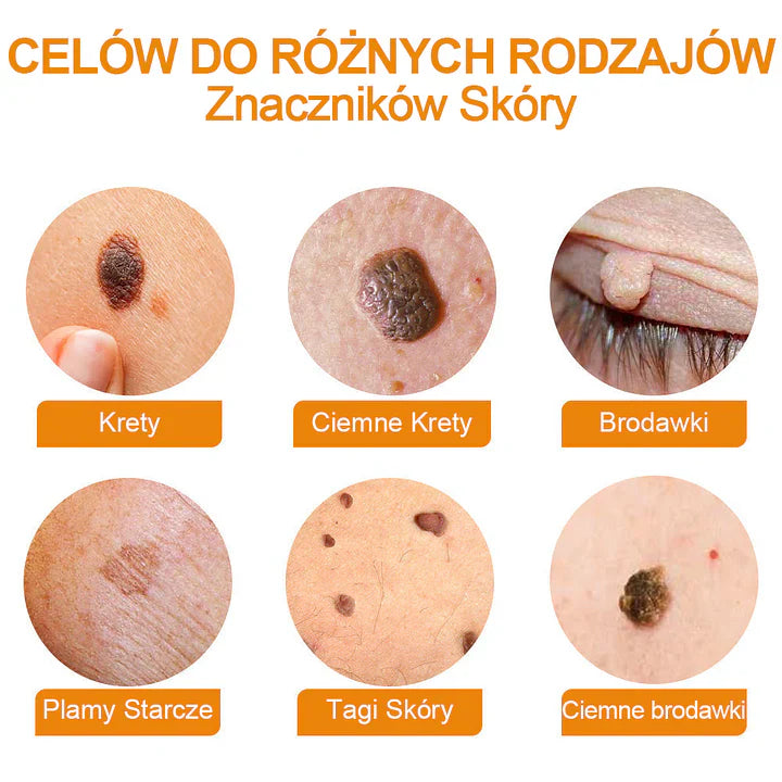 【✨Za pobraniem✨】Vsoxa™ Krem do usuwania brodawek i pieprzyków z jadem pszczelim (👨⚕Zalecenia AAD) 🐝🐝 (🔥Ostatni dzień wyprzedaży 70% taniej)