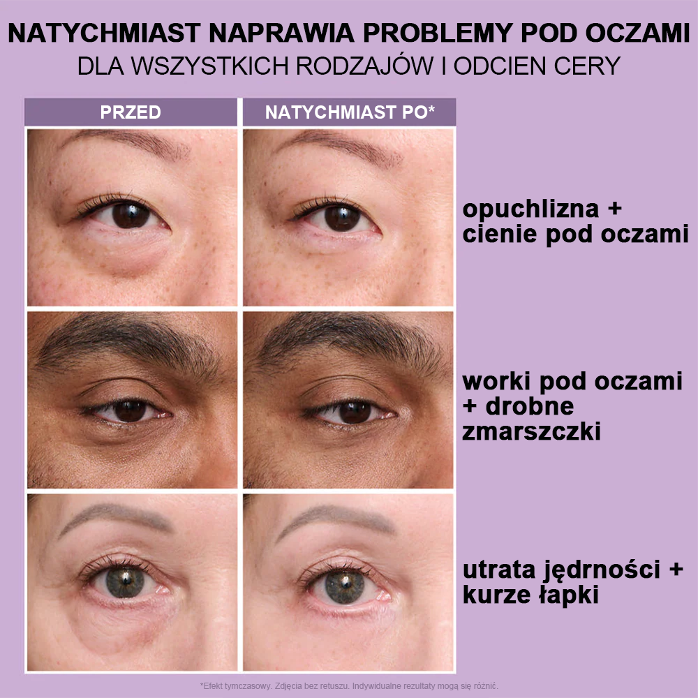 🌸Natychmiastowy Liftingujący Krem pod Oczy o Lekkiej Konsystencji – Maksymalne Ujędrnienie i Gładkie Wykończenie ✨