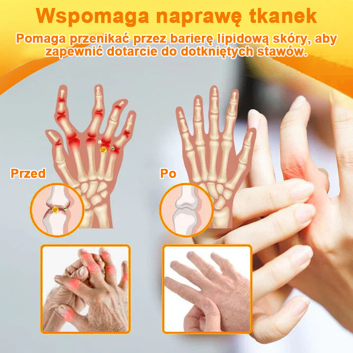 ✅Oficjalny sklep: Ourlyard™ Olej magnezowy i miód w sprayu do naprawy stawów👨⚕️Zatwierdzony przez Polską Agencję Leków, Wyrobów Medycznych i Produktów Biologicznych (URPL)🔥
