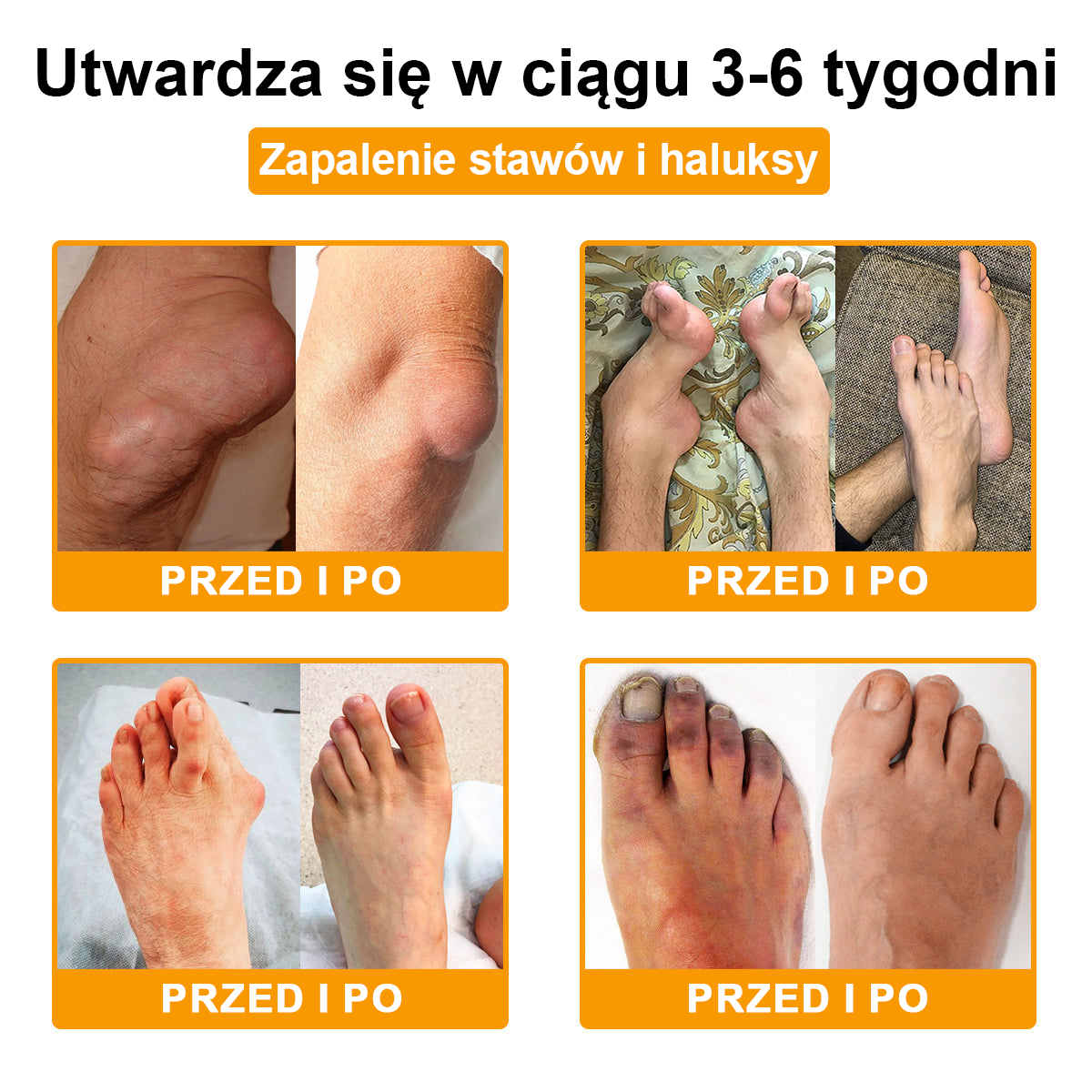 ✅ TLOPA® Przeciwbólowy krem wspierający regenerację kości z toksyną botulinową i jadem pszczelim 🐝🐝