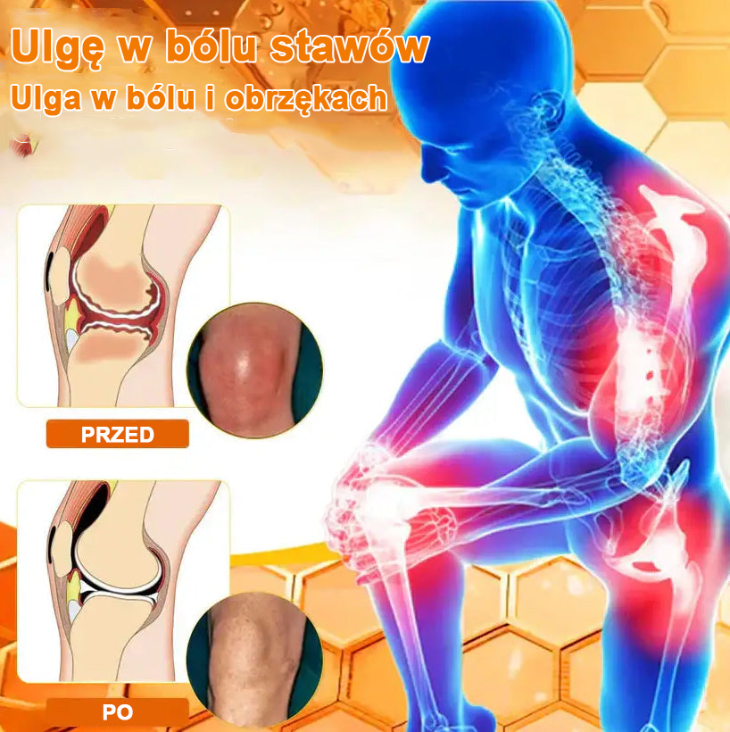 ✅Oficjalny sklep: Ourlyard™ Olej magnezowy i miód w sprayu do naprawy stawów👨⚕️Zatwierdzony przez Polską Agencję Leków, Wyrobów Medycznych i Produktów Biologicznych (URPL)🔥