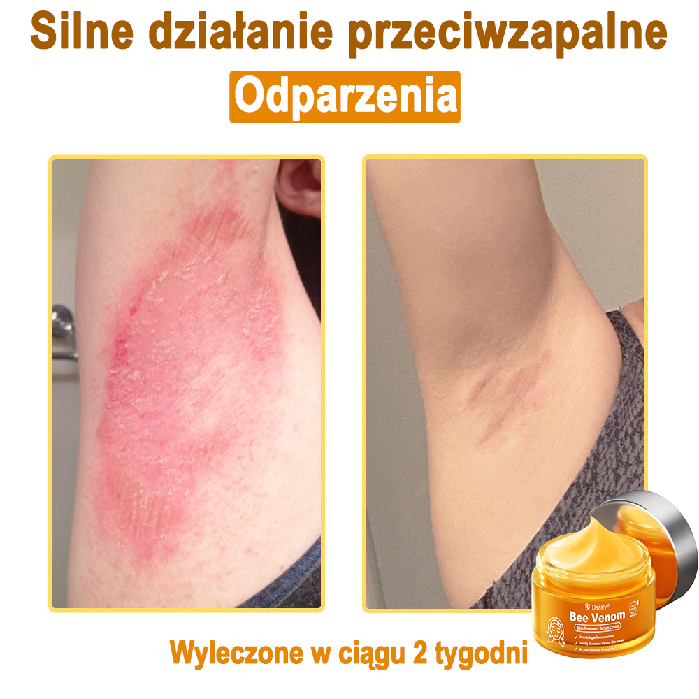 Daasry® 𝑩𝒆𝒆 𝑽𝒆𝒏𝒐𝒎 𝑺𝒌𝒊𝒏 𝑻𝒓𝒆𝒂𝒕𝒎𝒆𝒏𝒕 𝑺𝒆𝒓𝒖𝒎 𝑪𝒓𝒆𝒂𝒎👨⚕️ (Suitable for all ages & TGA recommends)