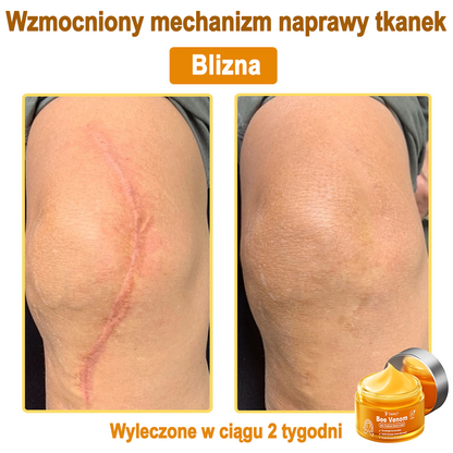 Daasry® 𝑩𝒆𝒆 𝑽𝒆𝒏𝒐𝒎 𝑺𝒌𝒊𝒏 𝑻𝒓𝒆𝒂𝒕𝒎𝒆𝒏𝒕 𝑺𝒆𝒓𝒖𝒎 𝑪𝒓𝒆𝒂𝒎👨‍⚕️ (Suitable for all ages & TGA recommends)