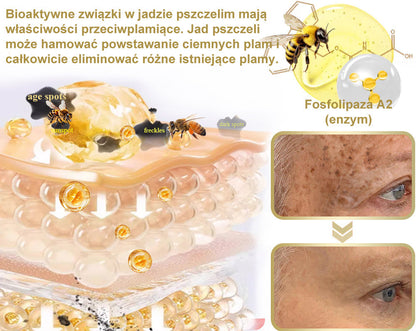 Płatność przy odbiorze 💰 PLTOWE® Krem z jadem pszczelim na kurzajki i pieprzyki 🐝 (👨‍⚕Zalecany przez dermatologów AAD) 🔥 Ostatni dzień promocji – 70% taniej!