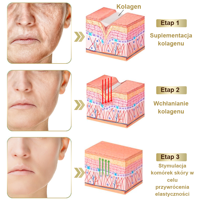 Płatność przy odbiorze 💰 PLTOWE® Krem z jadem pszczelim na kurzajki i pieprzyki 🐝 (👨‍⚕Zalecany przez dermatologów AAD) 🔥 Ostatni dzień promocji – 70% taniej!