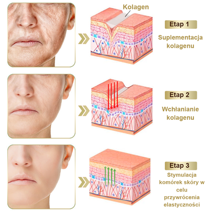Płatność przy odbiorze 💰 PLTOWE® Krem z jadem pszczelim na kurzajki i pieprzyki 🐝 (👨‍⚕Zalecany przez dermatologów AAD) 🔥 Ostatni dzień promocji – 70% taniej!