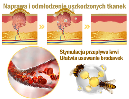 Płatność przy odbiorze 💰 PLTOWE® Krem z jadem pszczelim na kurzajki i pieprzyki 🐝 (👨‍⚕Zalecany przez dermatologów AAD) 🔥 Ostatni dzień promocji – 70% taniej!