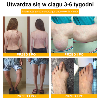 ✅ TLOPA® Przeciwbólowy krem wspierający regenerację kości z toksyną botulinową i jadem pszczelim 🐝🐝