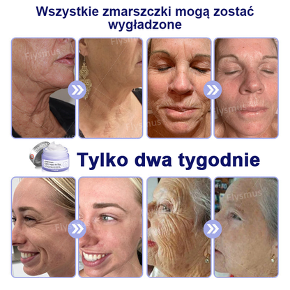 🎁Promocja specjalna – Flysmus® AH-8 Krem do napięcia i liftingu szyi – Ostatni dzień zniżki 70%