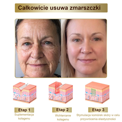 Płatność przy odbiorze 💰 PLTOWE® Krem z jadem pszczelim na kurzajki i pieprzyki 🐝 (👨‍⚕Zalecany przez dermatologów AAD) 🔥 Ostatni dzień promocji – 70% taniej!