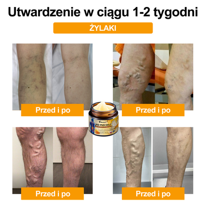 Oficjalny sklep: Aetheris™ Krem terapeutyczny z jadem pszczelim na natychmiastową, ultra silną ulgę w bólu - (Zapewnia eliminację bólu przy zapaleniu stawów, bólach mięśni, pleców, kolan, ramion, bioder, nadgarstków, dłoni)