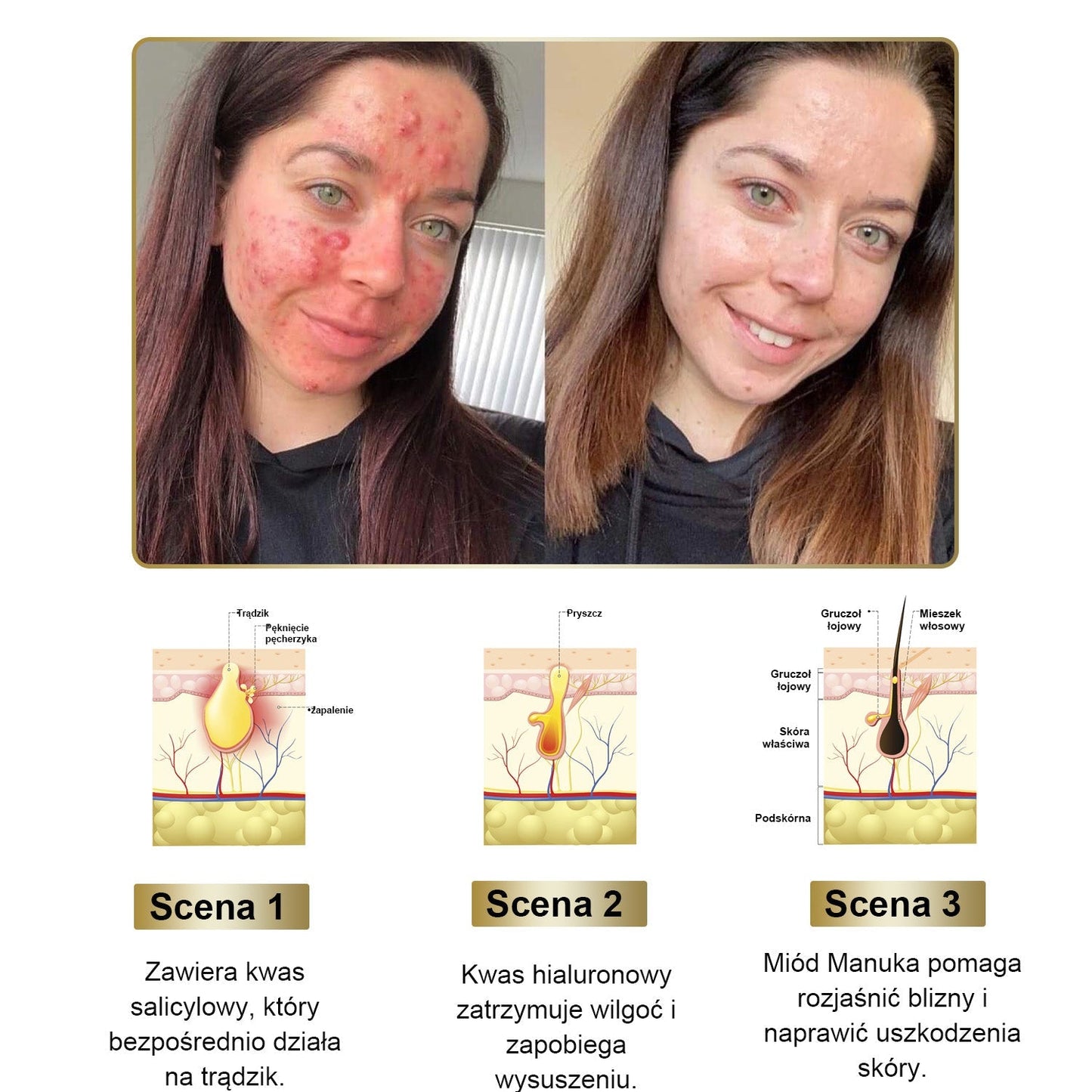 Płatność przy odbiorze 💰 PLTOWE® Krem z jadem pszczelim na kurzajki i pieprzyki 🐝 (👨‍⚕Zalecany przez dermatologów AAD) 🔥 Ostatni dzień promocji – 70% taniej!